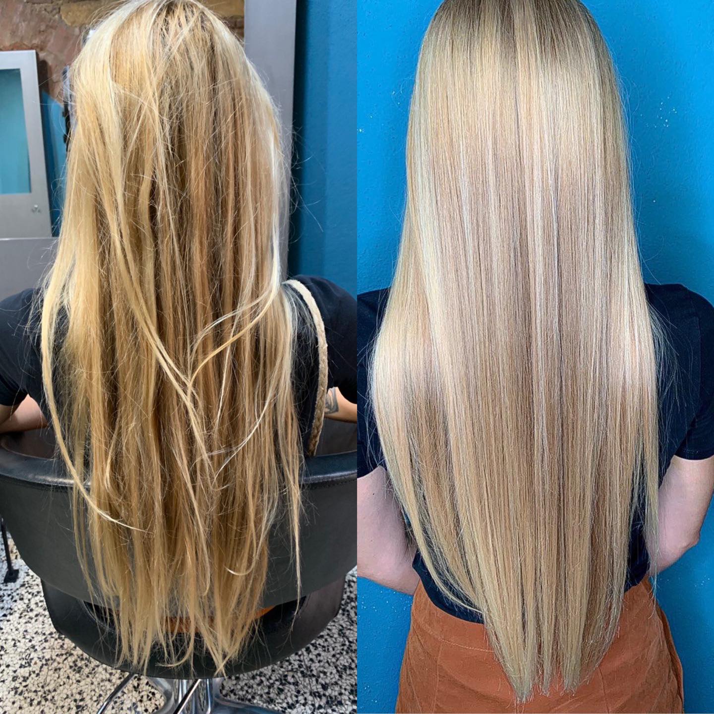 Extension dopo nanoplastia: si possono applicare?