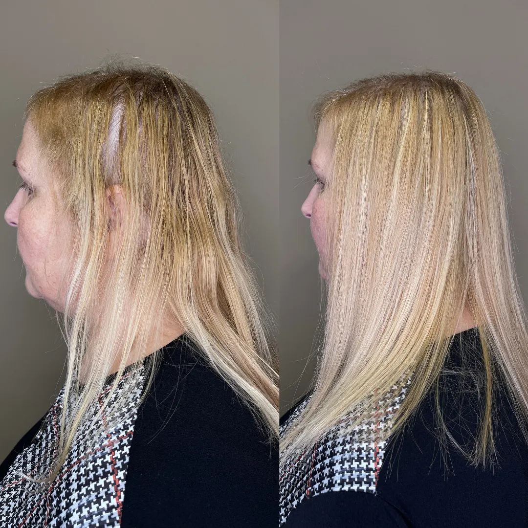 risultato-infoltimento-capelli-radi-san-marino.jpg
