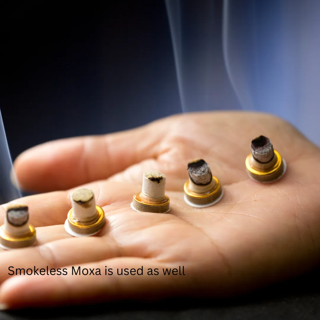 cupping therapy moxibustion electroacupuncture auricular acupuncture dry needling