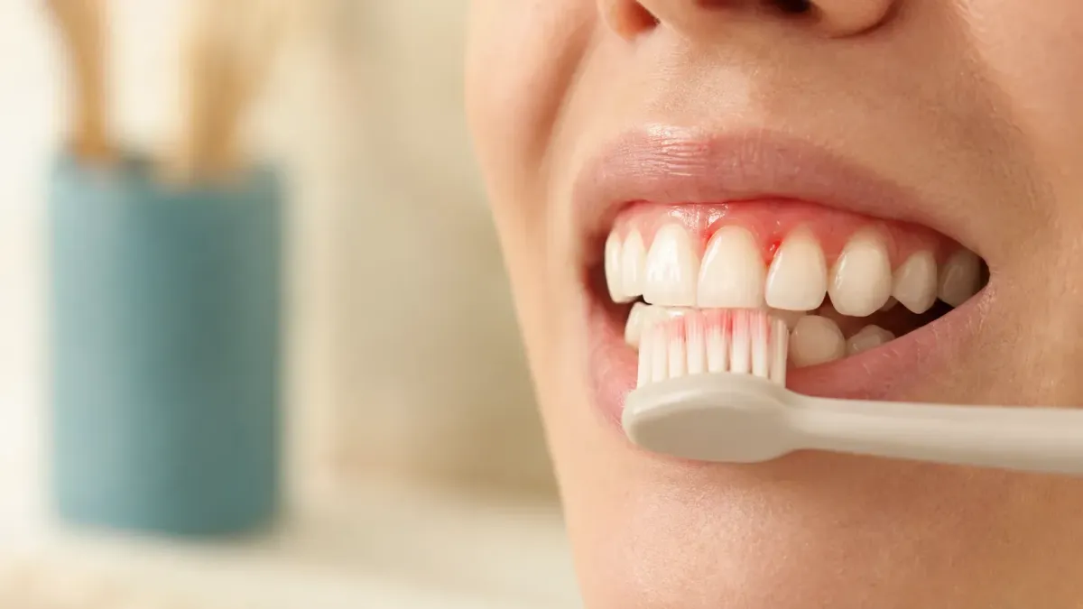 Close-up of bleeding gums while brushing teeth, showing early signs of gingivitis
