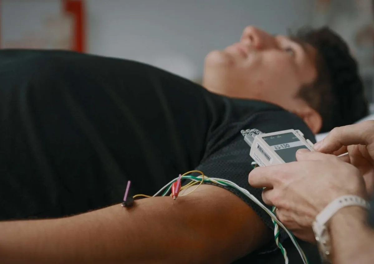 Dry Needling
