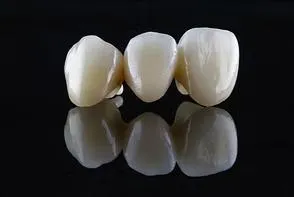 Crowns & Bridges, Great Impressions Dental Lab, Richmond VA