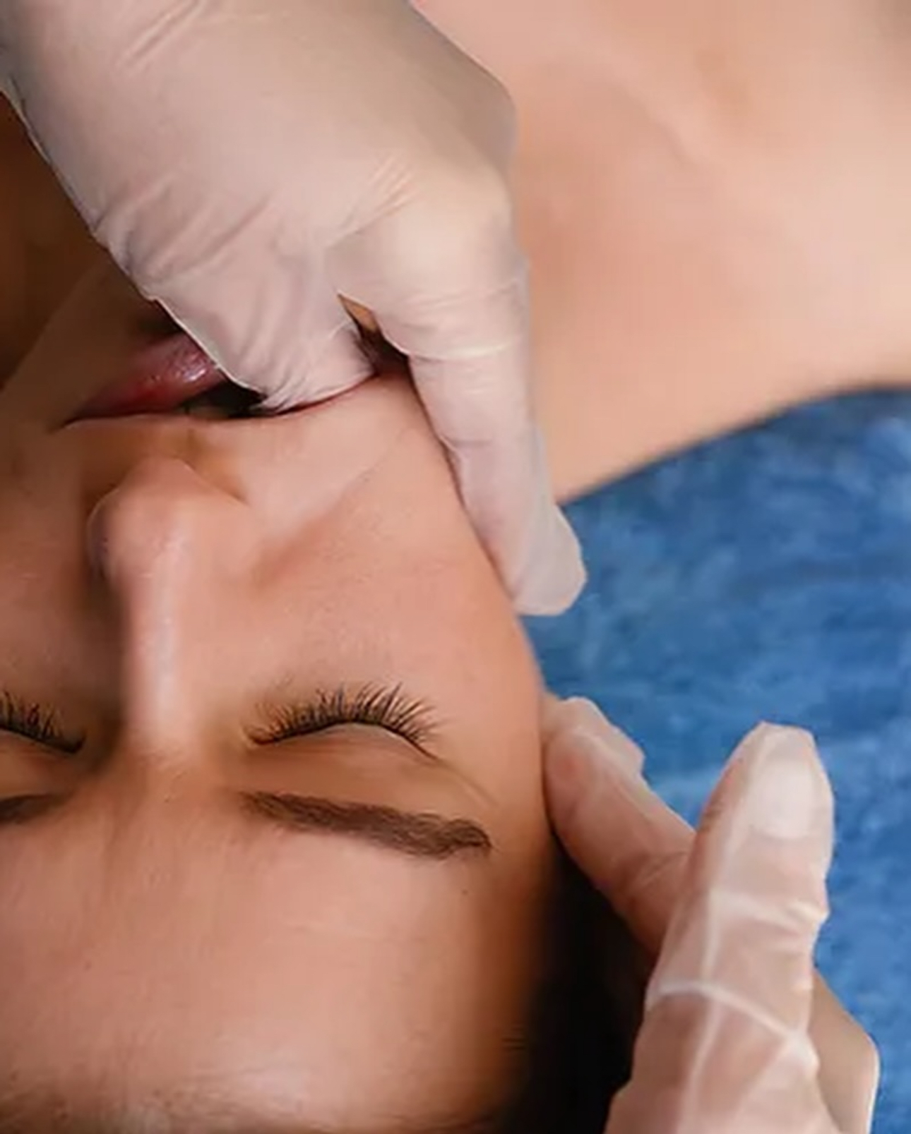 Scultural Buccal facial massage Boca Raton