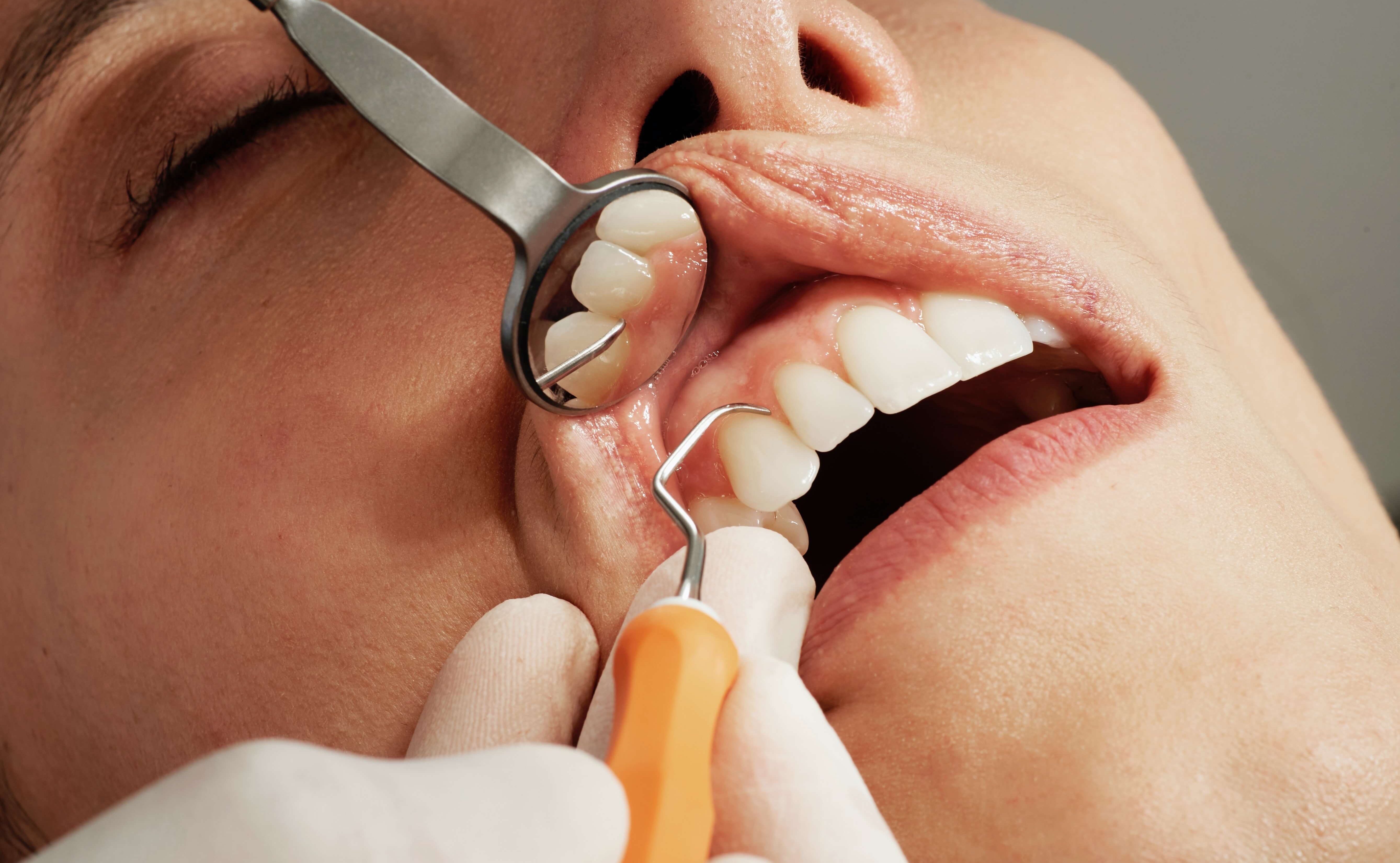 Dentist at work at Pure Dental Care - Trusted Dental Clinic in Utako, Abuja