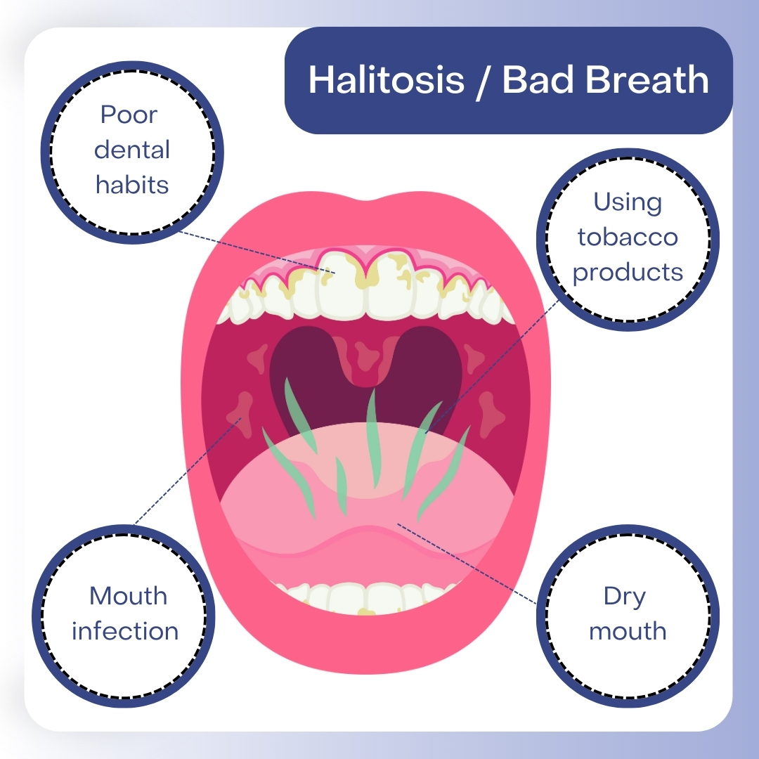 Dentist treating halitosis at Pure Dental Care - Trusted Dental Clinic in Utako, Abuja