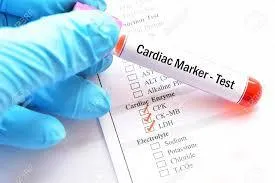 Cardiac Markers at De Rock Hospital and Diagnostic Center, Benin City Edo