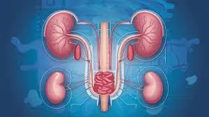 Urology at Top Medical Centre, Minna, Niger State