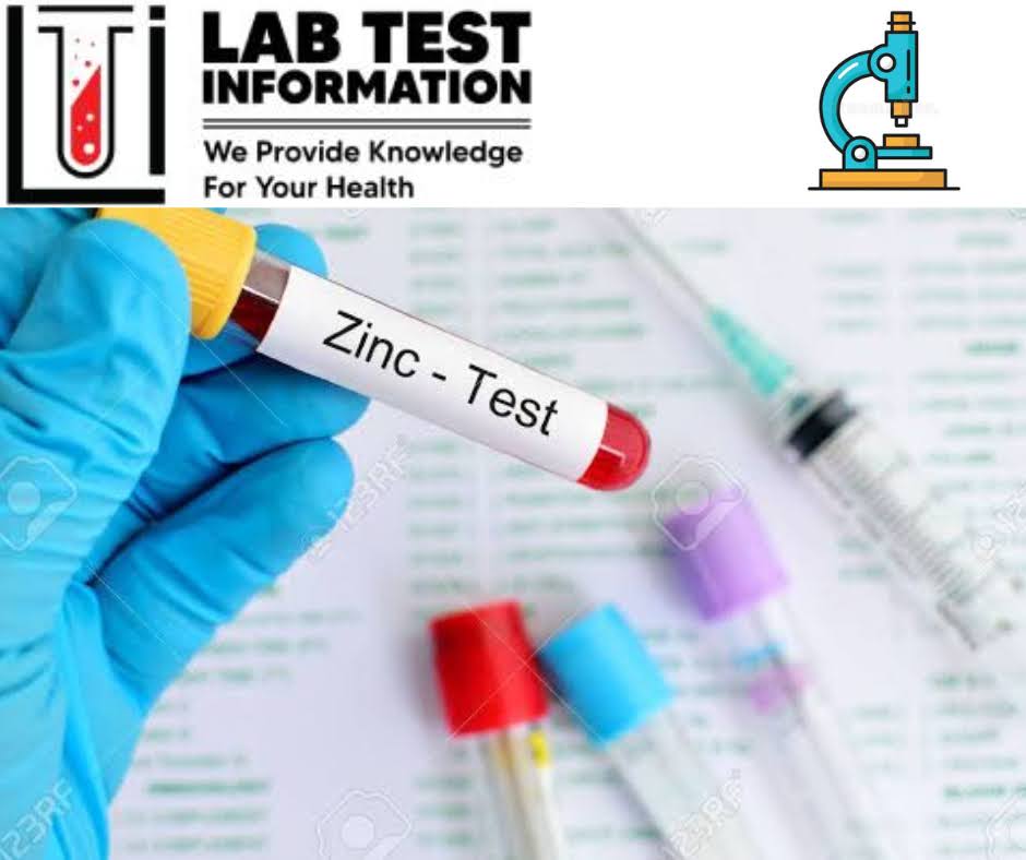 Accurate Test Analysis Using Standard Procedures at Zrof Hospital & Diagnostic Center, Malete–Elemere Road, Lamarida Junction, Beside Zrof Pharmacy, Moro LGA, Kwara state