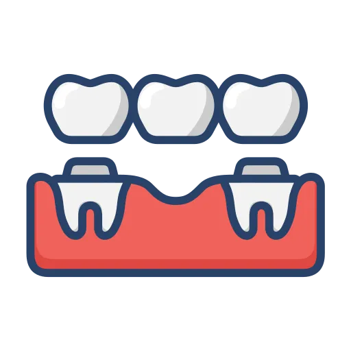 Bridges, Crowns & Dentures at Kingsrose Specialist Dental Clinic, Karu, Abuja