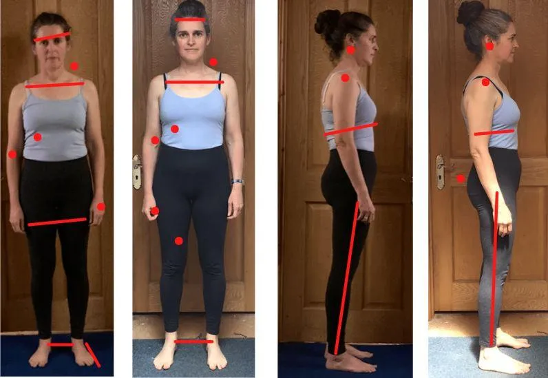 Veronica before-and-after photos showing changes in posture and body alignment for looking and feeling younger
