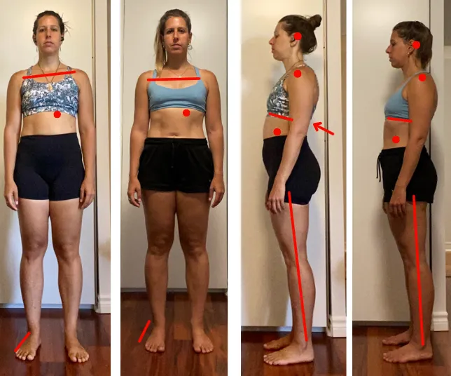 Talia before-and-after photos showing changes in posture and body alignment for knee pain