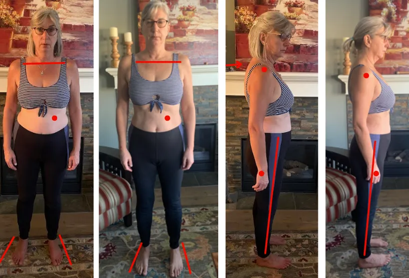 Tracy M before-and-after photos showing changes in posture and body alignment for neck pain