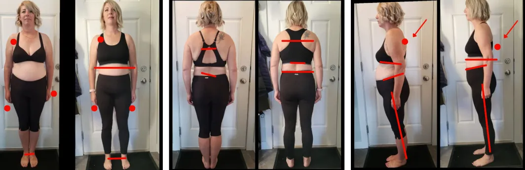 Pauline's before-and-after photos showing changes in posture and body alignment for back pain