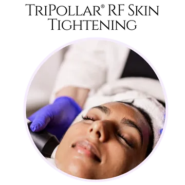 TriPollar® RF Skin Tightening in Surrey, BC