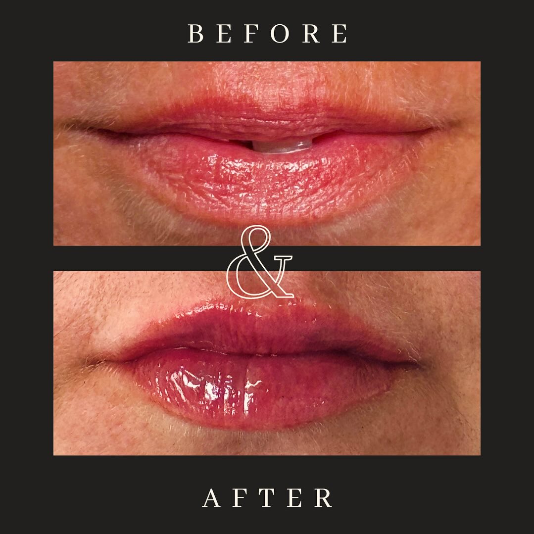 Placeholder aesthetic before and after style image 2