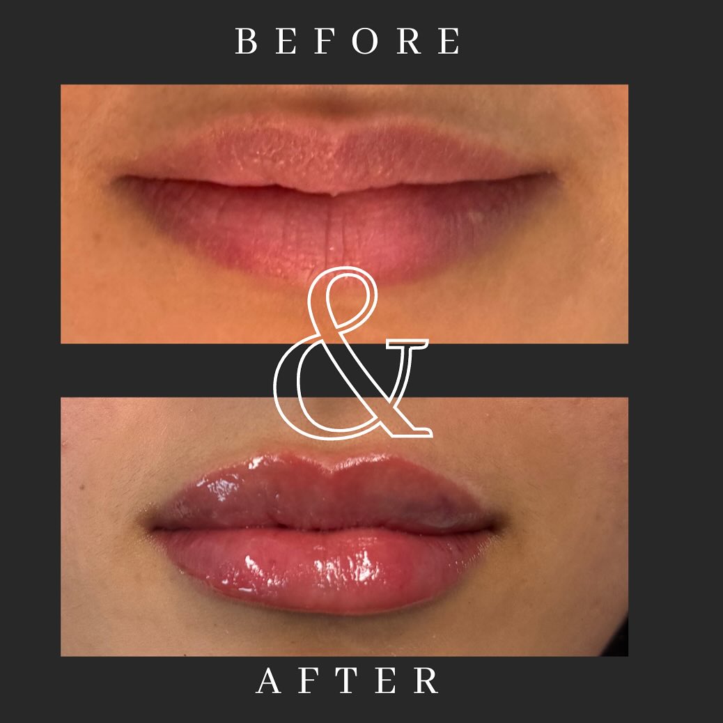 Placeholder aesthetic before and after style image 3