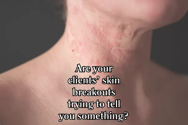 Are your clients' skin breakouts trying to tell you something?