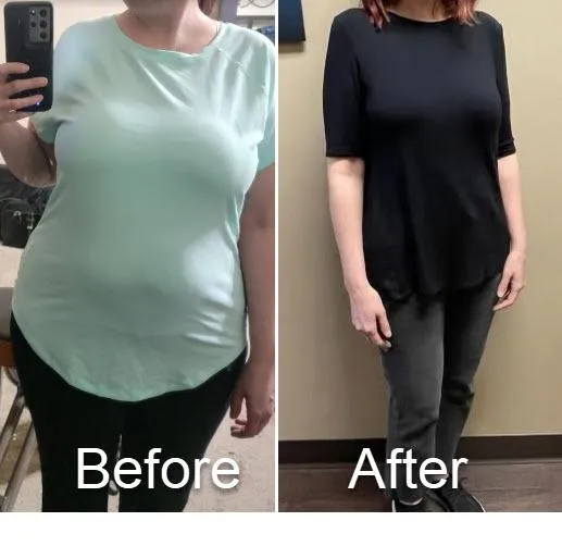 Another Before After Success from CFP Weight Loss Nashville