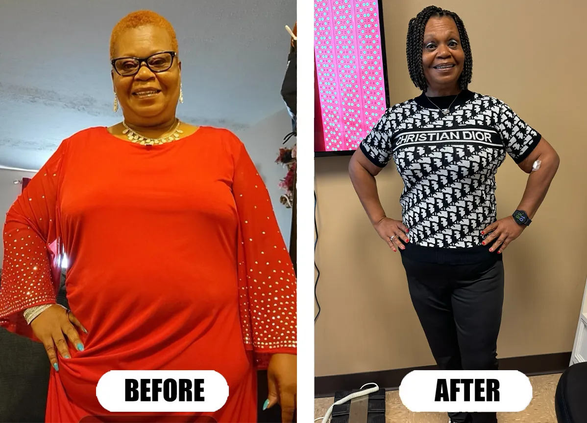 Another Before After Success from CFP Weight Loss Nashville