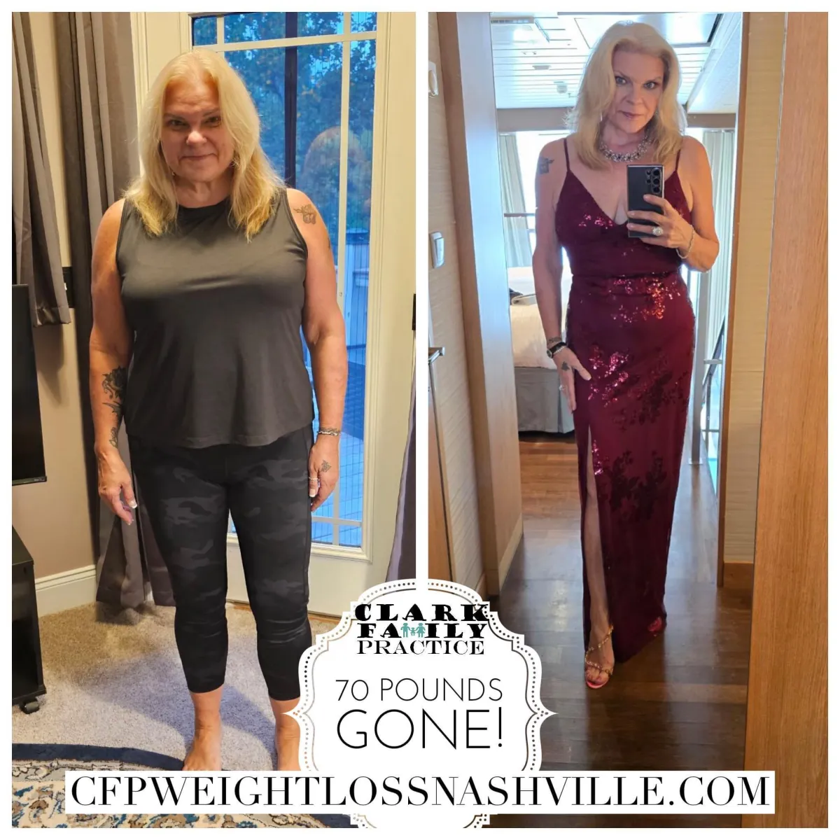 Another Before After Success from CFP Weight Loss Nashville