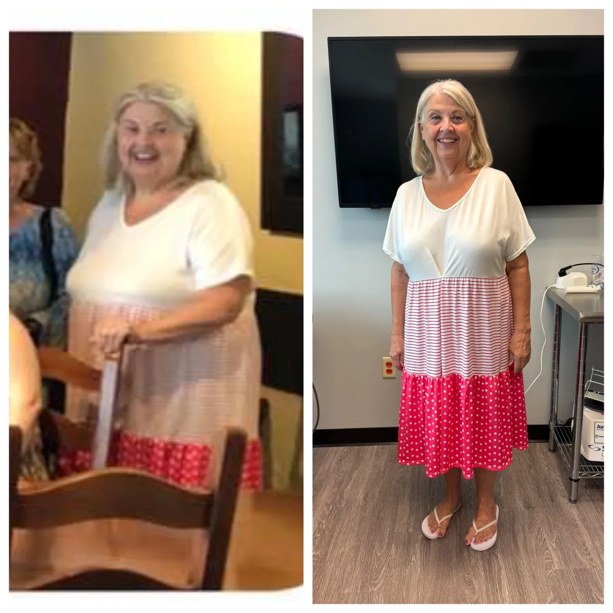 Another Before After Success from CFP Weight Loss Nashville