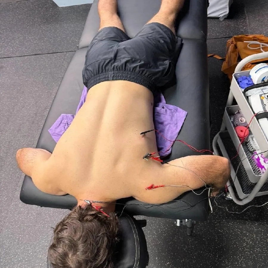 dry needling with e-stim