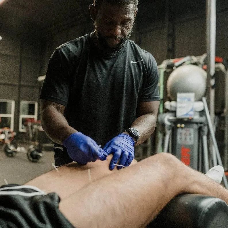 Dry Needling Therapy