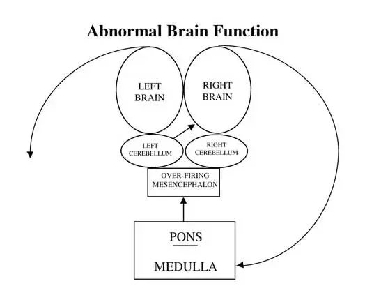abNormal brain function diagram 