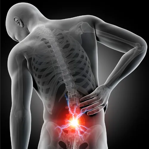 Back Pain herniated disc  dr. Andy Barlow chiropractor tupelo