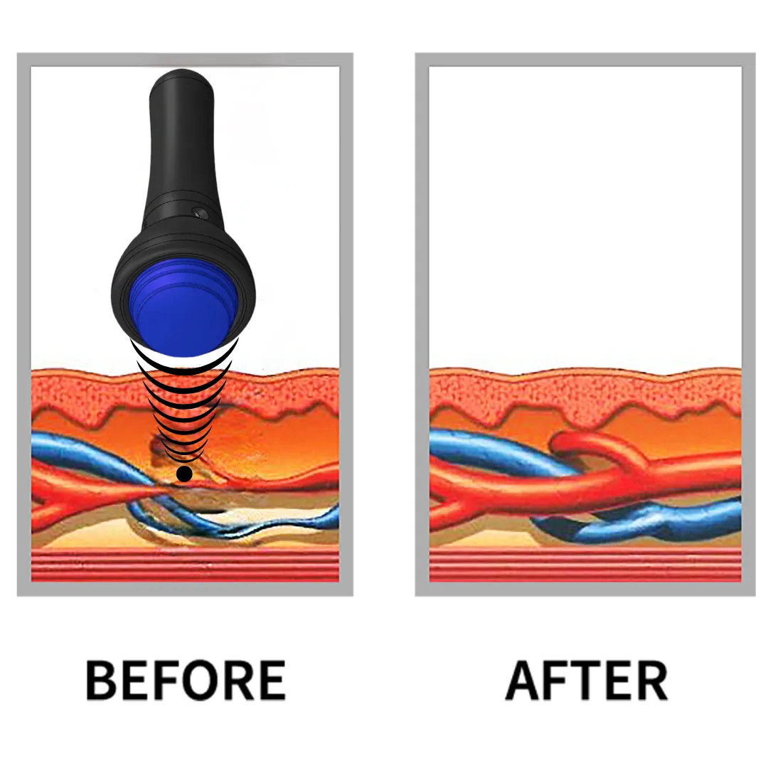 Before and after GainsWave png