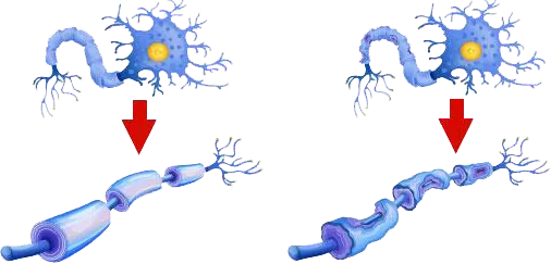 Neuropathy nerve damage