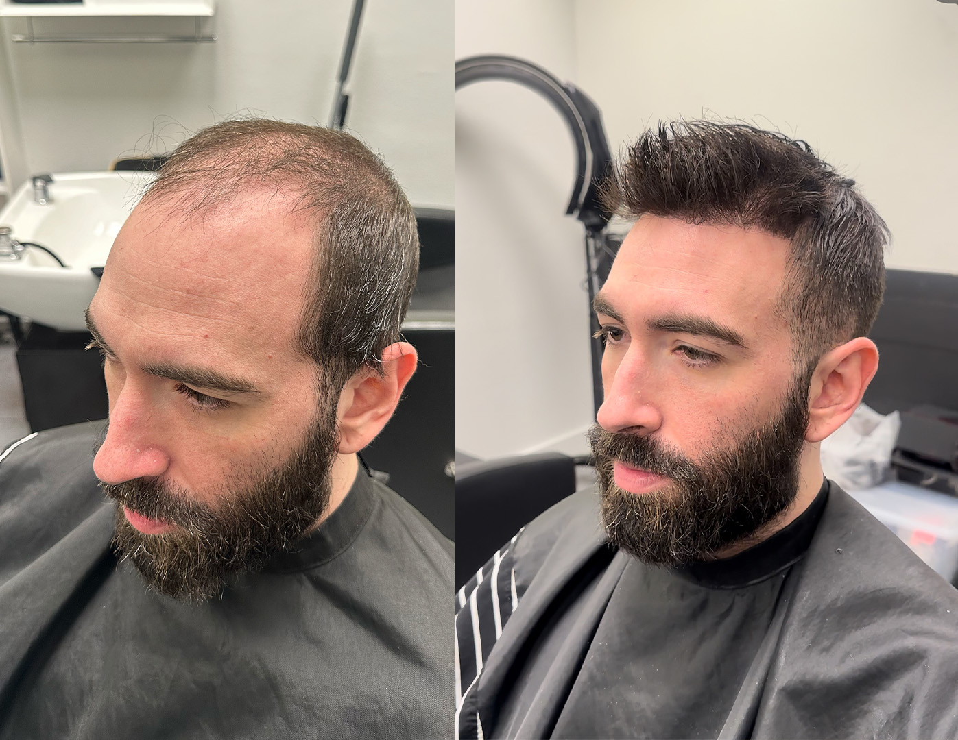 hair system installs in new orleans