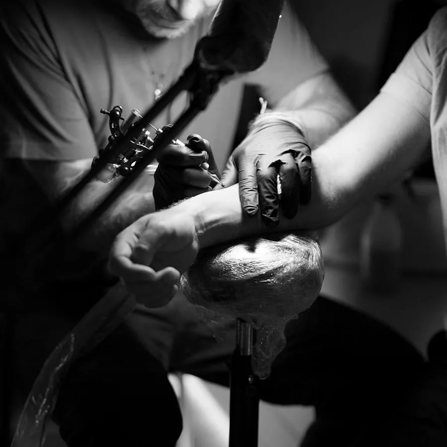 Service Tattoo Removal