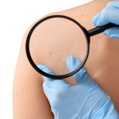 <img src="weight-loss-before-after.jpg" alt="Before and after photos of a woman showing significant weight loss after using our treatment">