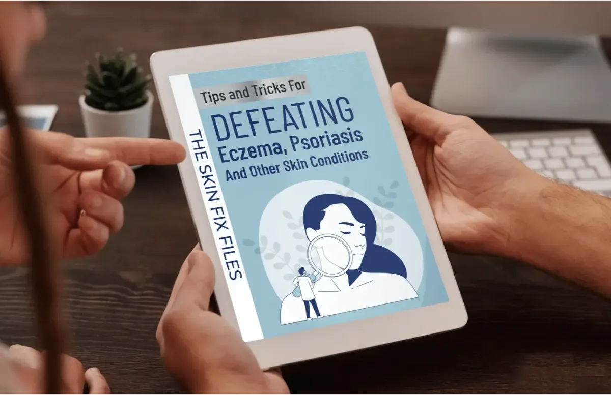 free ebook 1 - The Skin Fix Files: Tips and Tricks for Defeating Eczema, Psoriasis And Other Skin Conditions