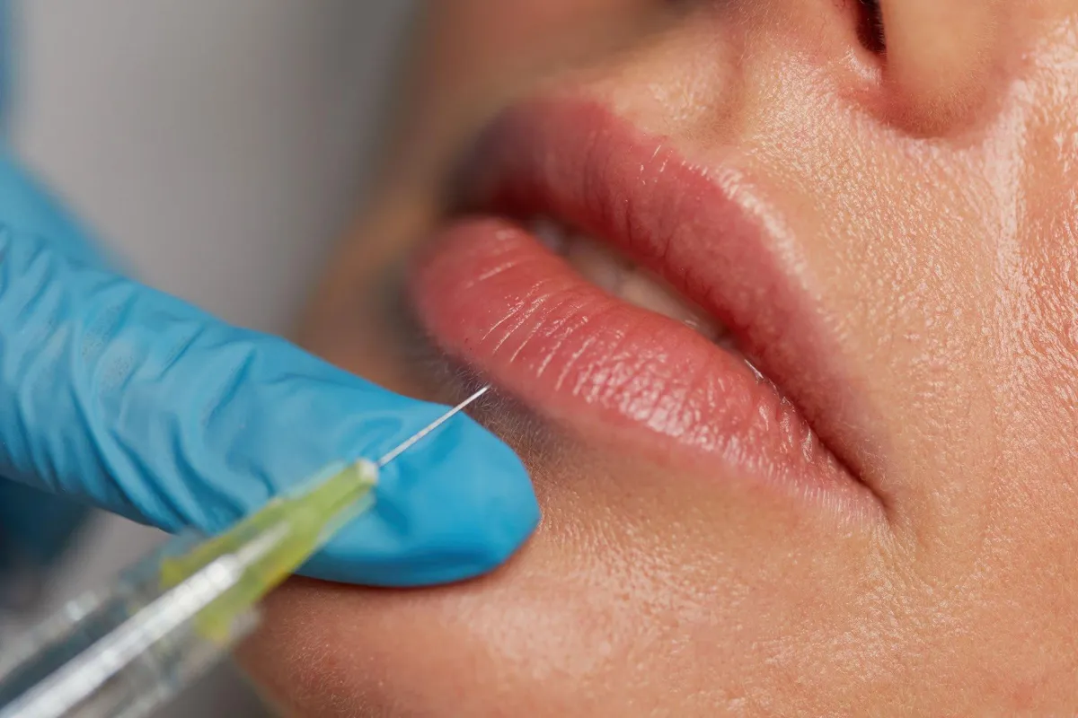 Botox, facial fillers, facial threads, lip fillers