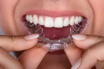 Celina Texas dentist at Open Late Dental and Orthodontics provides clear orthodontic trays for a confident smile