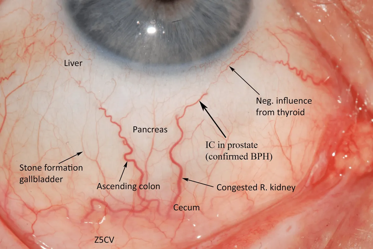 Sclera reading of an individual