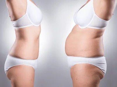 Aesthetic Repository weight loss service