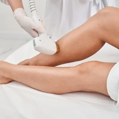 Laser Hair Removal Services MN