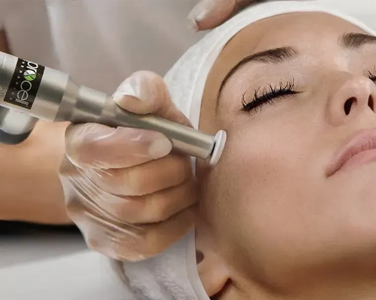 Fine Fine lines, wrinkles, scarring, stretch marks, skin healing, Mico-channeling, Procell therapy in Villa Rica, Ga, Villa Rica Ink, Beauty Social by VRI, wrinkles, scarring, stretch marks, skin healing, Mico-channeling, Procell therapy in Villa Rica, Ga, Villa Rica Ink, Beauty Social by VRI