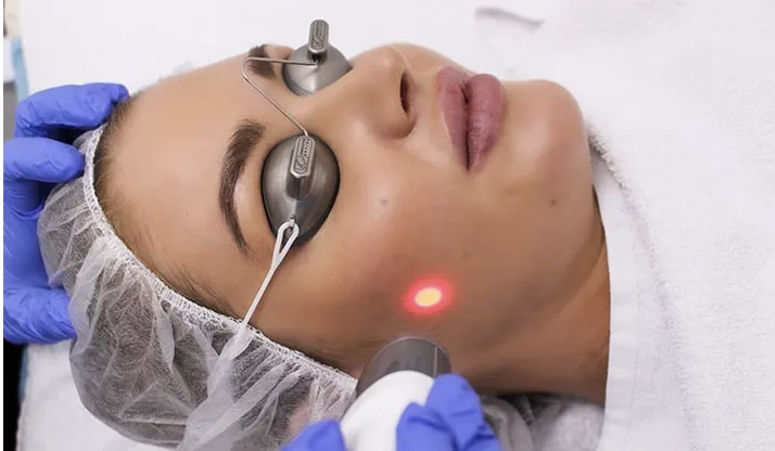 Laser Genesis skin rejuvenation treatment being performed on a patient at Lift Med Spa in Houston, with protective eyewear ensuring a safe and comfortable experience.