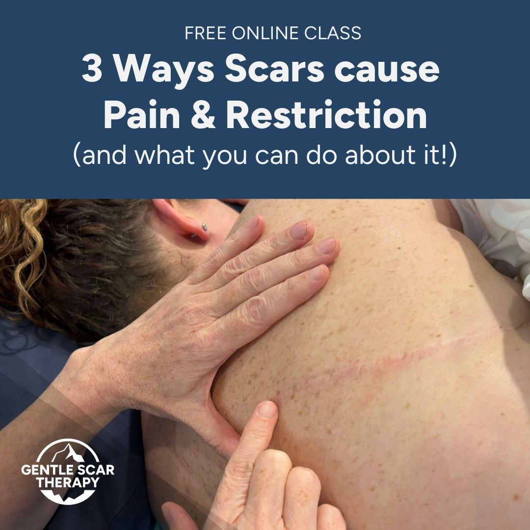 Free Class – Gentle Scar Therapy