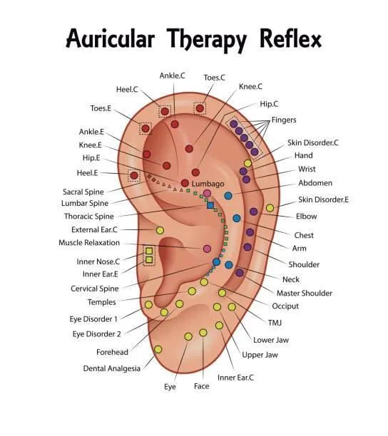 Acupuncture Image