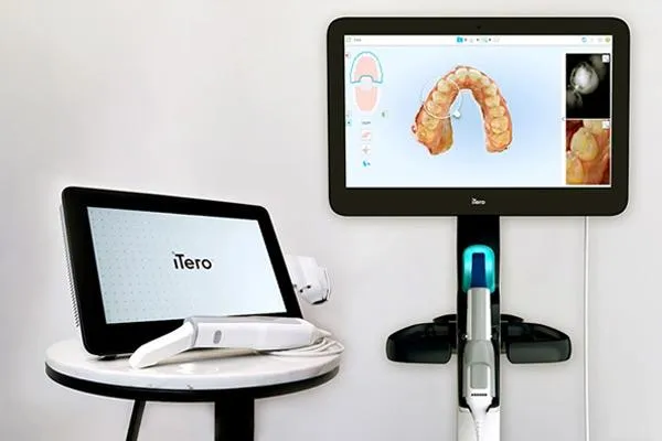 iTero Scanner