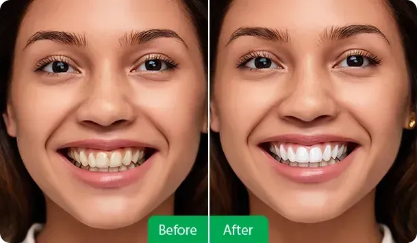 Before/After - Dentist at Towne Centre
