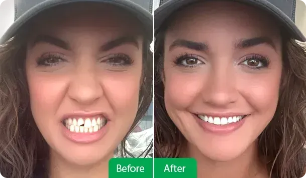 Before/After - Dentist at Towne Centre