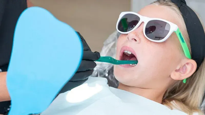 Veneers