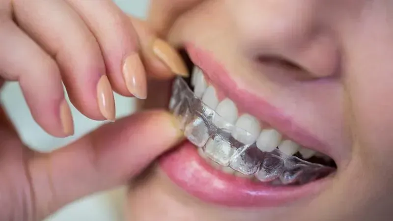 Invisalign West Chester OH