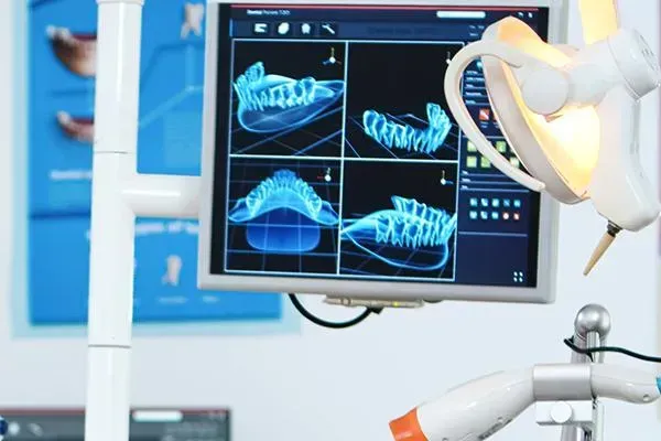 Intra-oral Camera Using by Dentist At Towne Centre